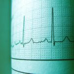 Close-up of an ECG printout displaying heartbeat rhythm and frequency for medical analysis.