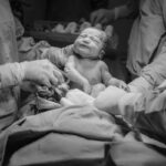 A newborn baby in a hospital delivery room, surrounded by medical practitioners during childbirth.