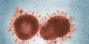 Colorized electron microscope image showing coronavirus particles with distinct spike proteins.