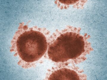 Colorized electron microscope image showing coronavirus particles with distinct spike proteins.