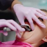 Dental professional using extracting forceps on a patient during a tooth extraction.