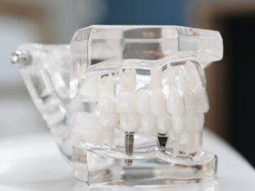 Transparent dental model showing teeth and implant screws, perfect for educational purposes.