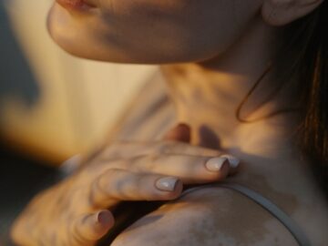 Close-up portrait showcasing the natural beauty and diversity of skin with vitiligo in warm, artistic light.