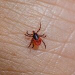 Detailed macro shot of a Castor Bean Tick (Ixodes ricinus) on human skin.