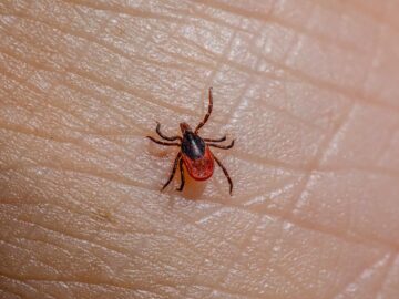 Detailed macro shot of a Castor Bean Tick (Ixodes ricinus) on human skin.