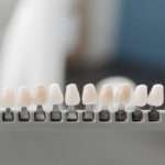 Close-up display of dental veneer samples in a holder, ideal for dentistry.