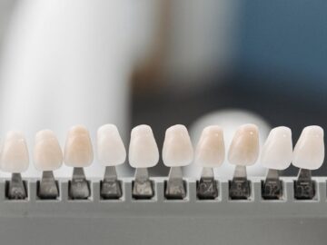 Close-up display of dental veneer samples in a holder, ideal for dentistry.