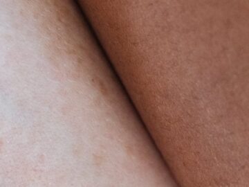 Detailed close-up showing the contrast between different skin tones and textures, highlighting diversity.