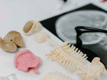 Detailed anatomical models and X-ray image in a medical study setup.