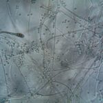 Detailed microscopic view showing fungal hyphae and spores, ideal for biology and microbiology themes.