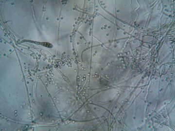 Detailed microscopic view showing fungal hyphae and spores, ideal for biology and microbiology themes.