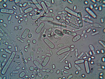 Close-up image of rod-shaped bacteria under a microscope, showcasing microscopic detail.
