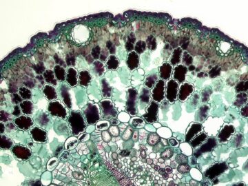 Detailed microscope view of plant cell structure in vivid colors.