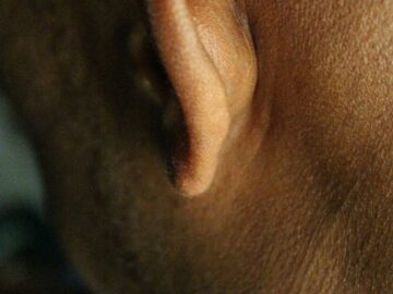 Detailed close-up view of a human ear showing skin texture for medical and anatomical study.