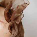 Close-up view of a scarred skin under sheer brown fabric, highlighting texture and detail.